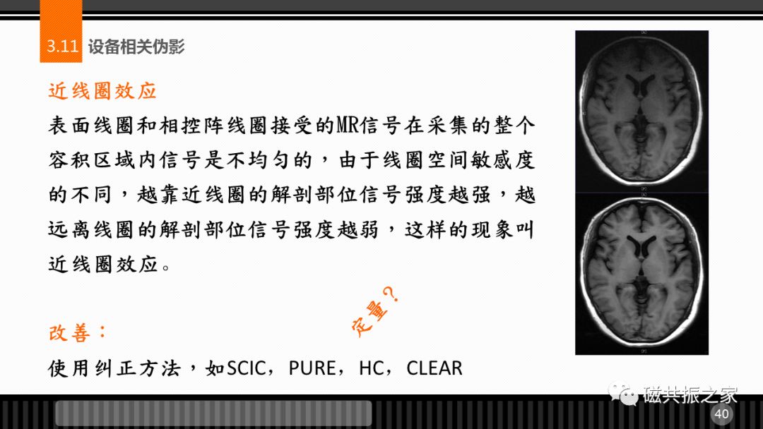 磁共振常见伪影及策略