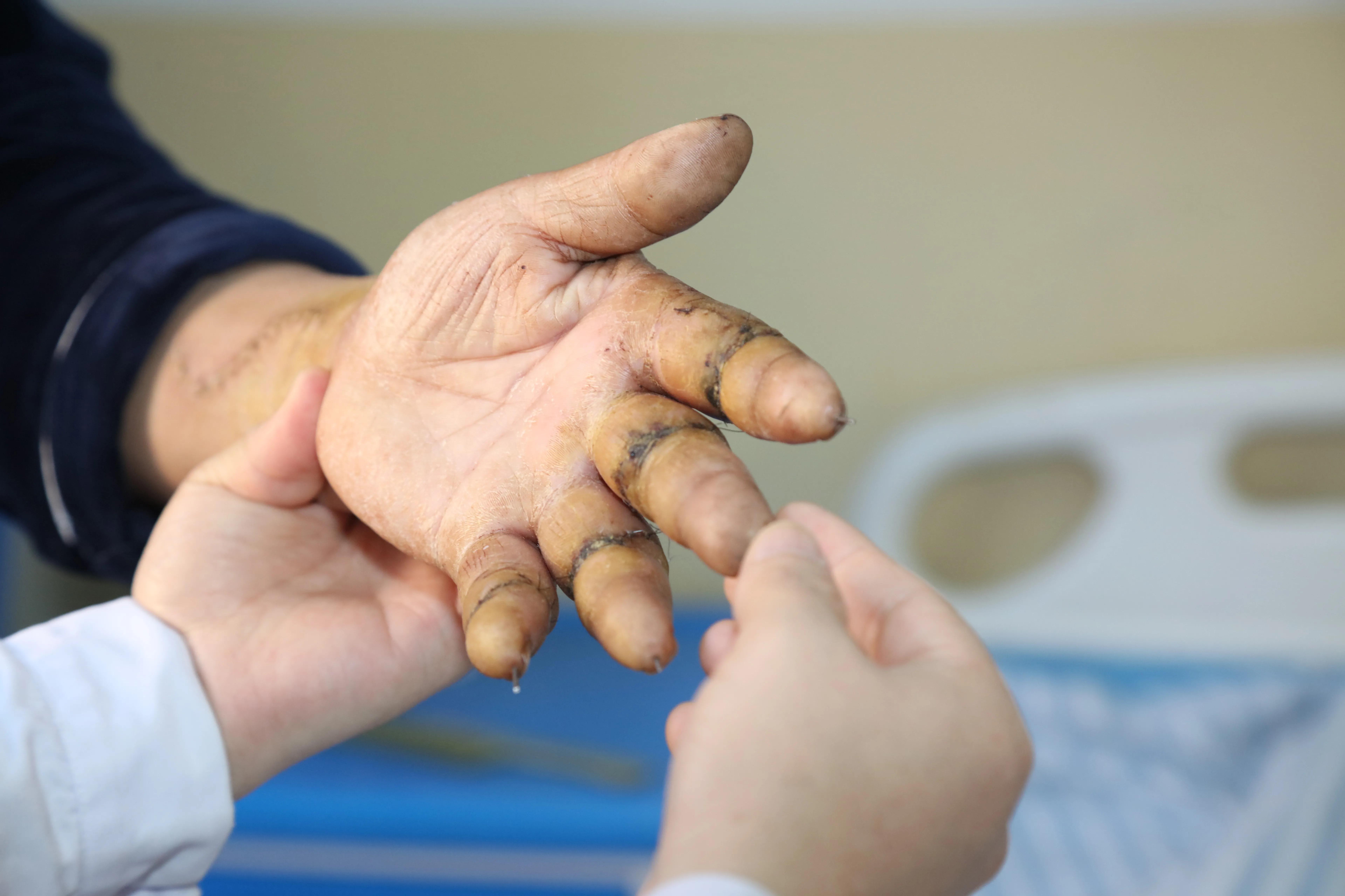 王东海是合阳县黑池镇西中雷村人,年前腊月26日,在操作剪版机加工