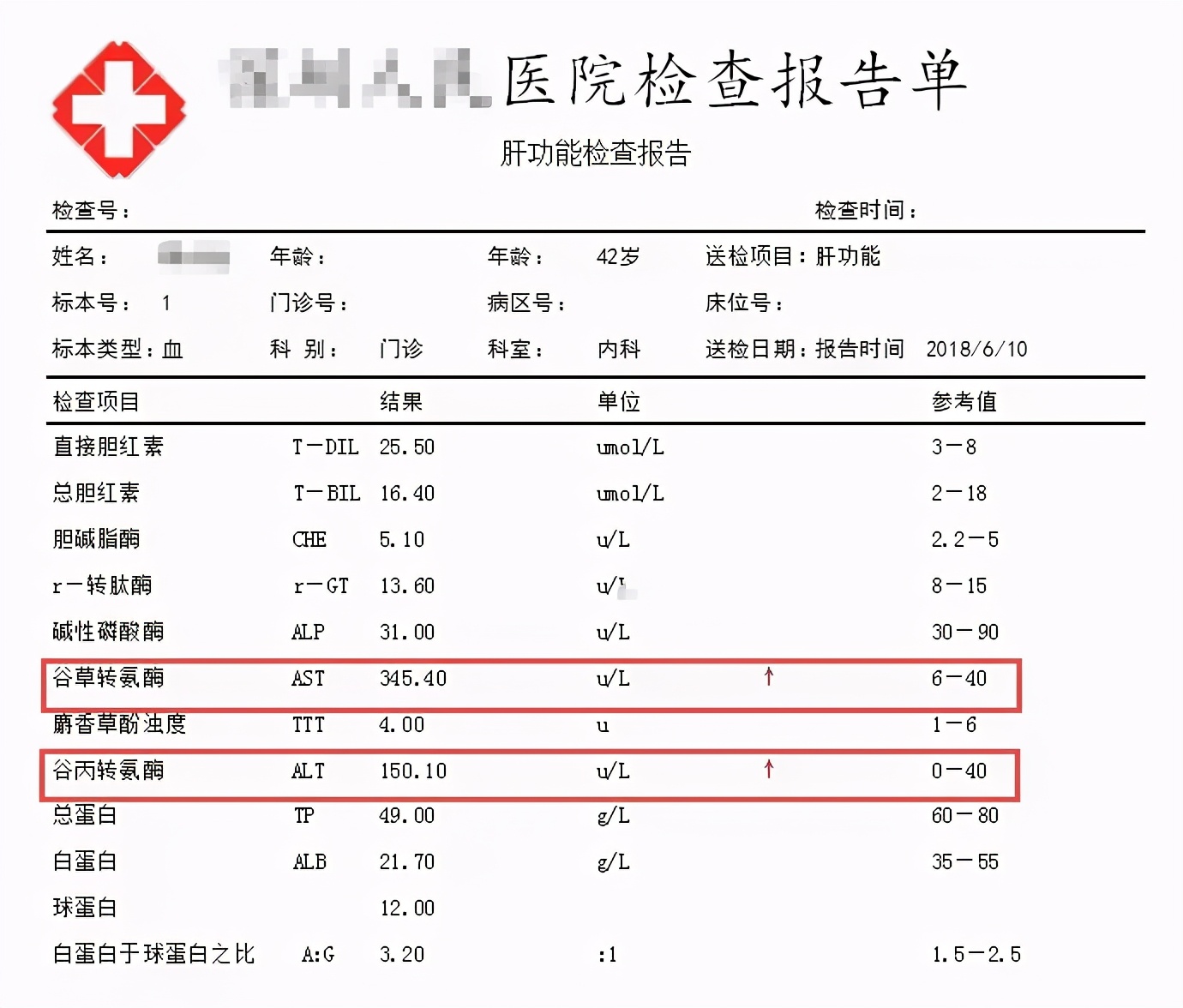 肝功能化验单_百度知道