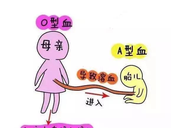 溶血症常见的症状有哪些?O型血女性怀孕需警惕溶血症