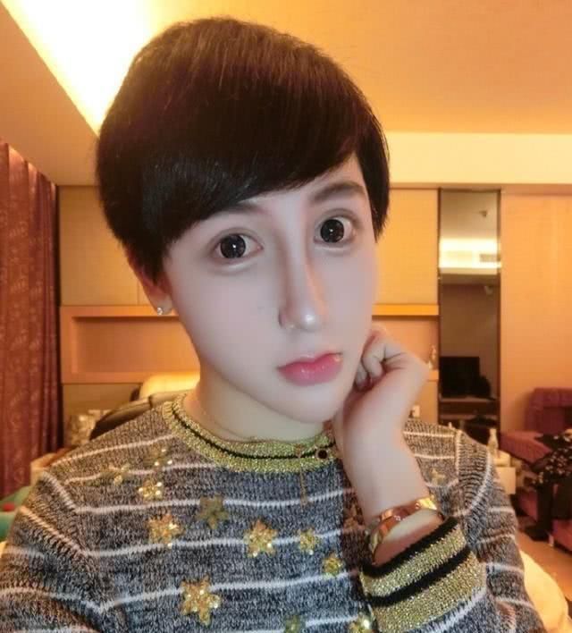 蛇精男刘梓晨近况曝光 全脸毁容崩溃 不知如何面对以后的生活 娱乐 蛋蛋赞
