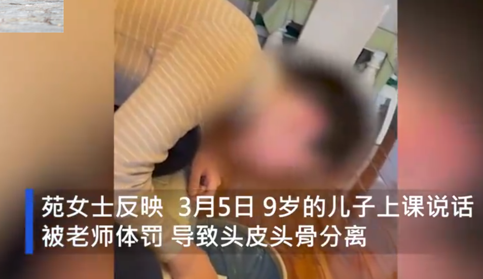 9岁男孩被老师体罚致头骨分离，做了7次穿刺，家长追责学校却称自己无责