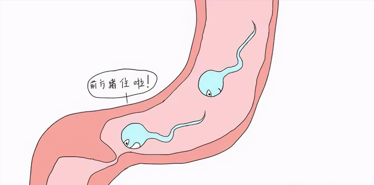 2,睾丸功能异常:睾丸肿瘤,睾丸萎缩,隐睾症等会影响睾丸生精