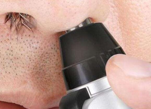 鼻毛为什么会窜出来？鼻毛旺盛暗示着什么？看完后长知识了