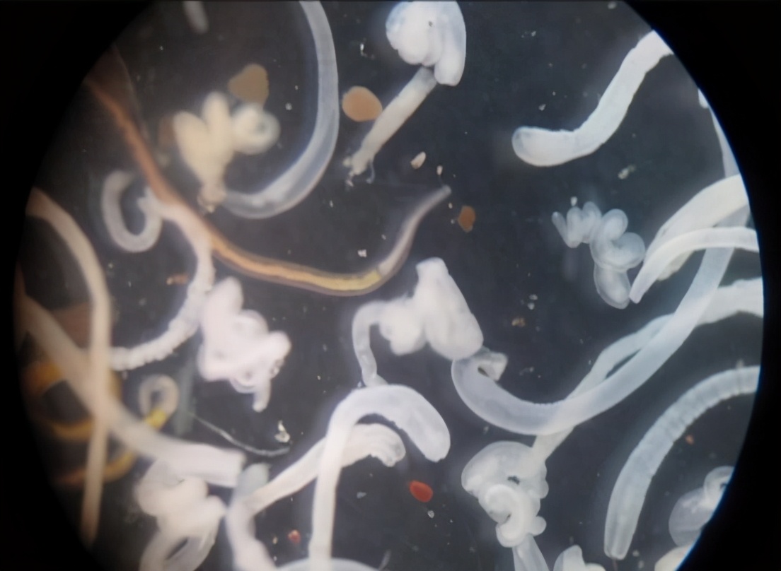 6歲男孩肚子疼，送到醫院肚子裡全是蟲，醫生怒斥媽媽給他吃這個