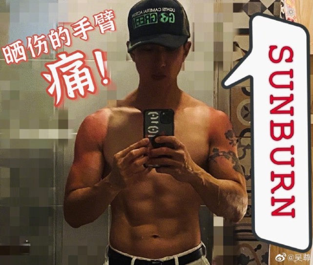 吳尊自曝想曬更黑不擦防曬，身體大片曬傷像塗了層醬油，看著都疼