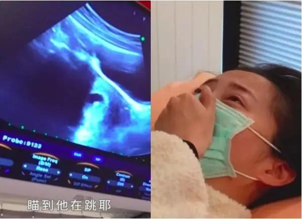 赵小侨胎停后痛苦引产12小时：宝宝，再见
