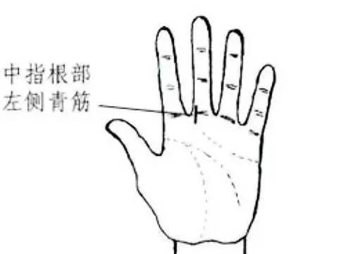 手上的每一条青筋,都代表不同常见病,详细图解一看就明白
