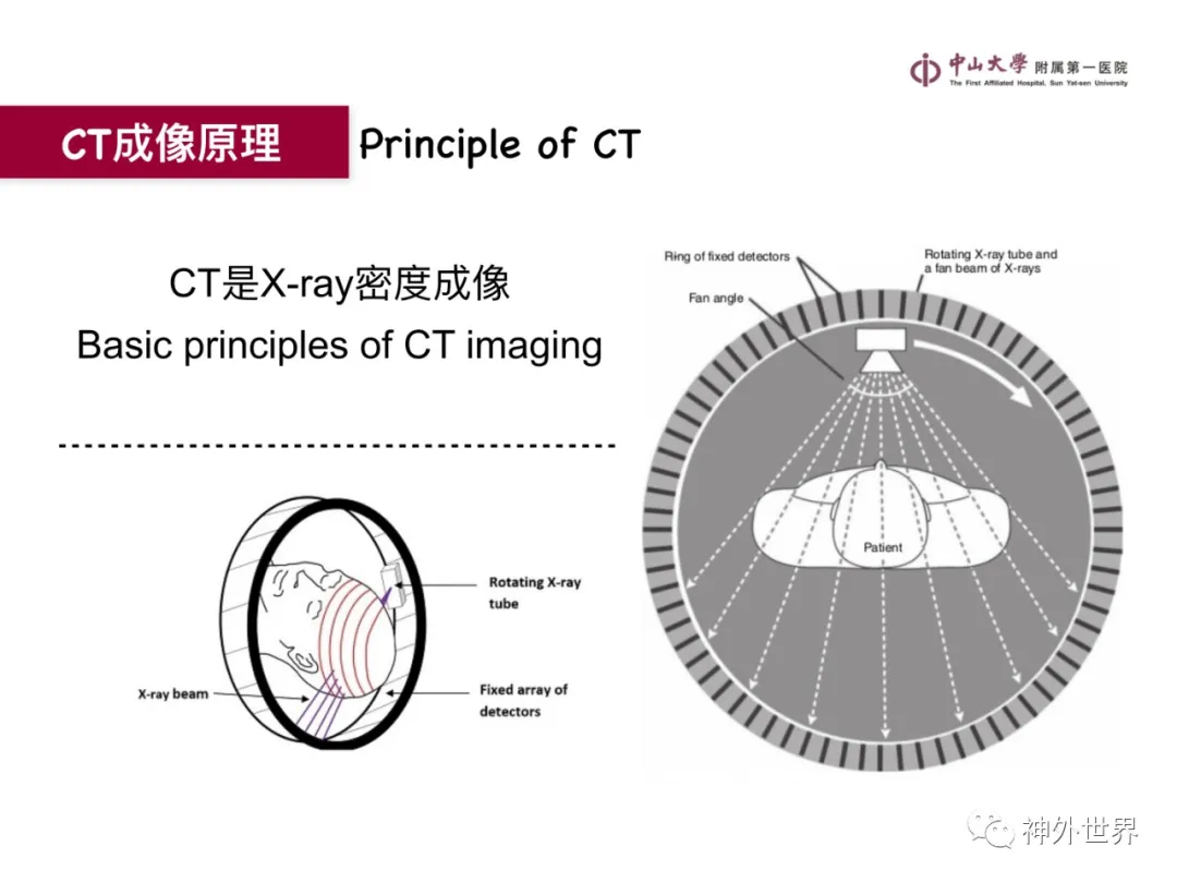 最全影像总结 | 颅内病变 MR、CT 的阅片技巧，太赞了