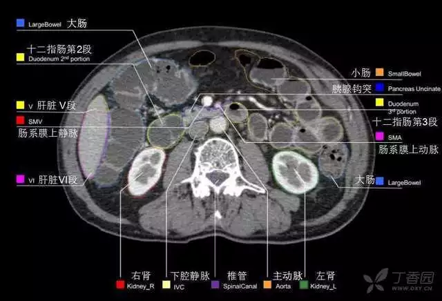 掌握这篇解剖，晋级腹部CT影像诊断高手（精细版）