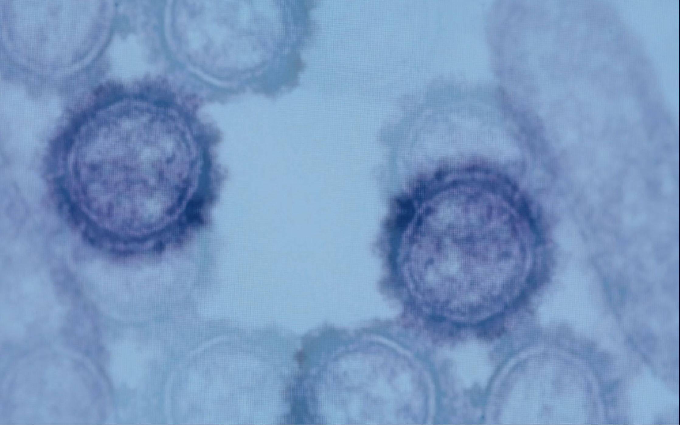 那一年的英国：学校关门，剧院关门，装尸体的