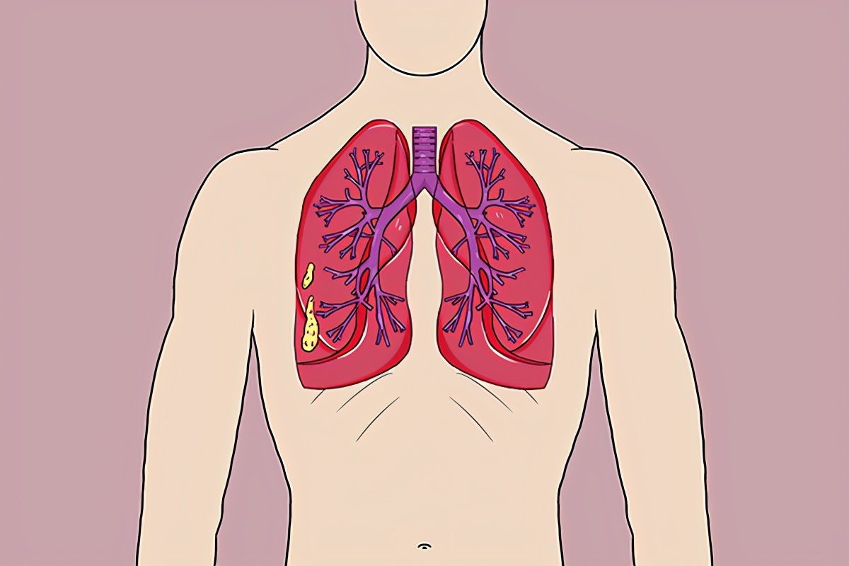 指甲上出現豎紋，是咋回事？ 月牙的多少，與健康有關？