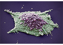 科学家发现癌细胞耐药的潜在机制