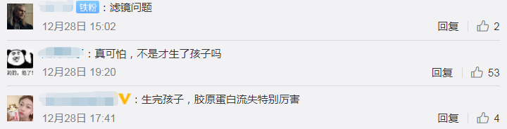 郭碧婷产后素颜出镜，整个人的状态每况愈下，豪门太太真的不好当