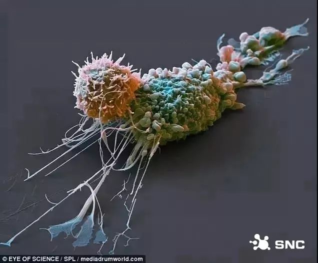 免疫细胞是如何消灭癌细胞？微观世界下的震撼战争