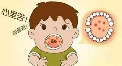 疱疹性咽峡炎，你家宝宝“中招”了吗？