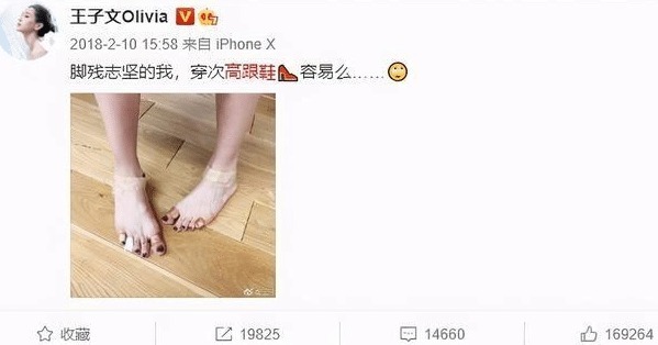 倪妮换平底鞋下班，宋茜脚趾外翻，女明星穿高跟鞋也是一部血泪史