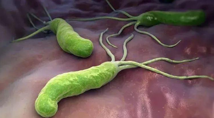 胃裡有幽門螺桿菌，嘴巴通常會發出3個信號，醫生：趁早檢查一下