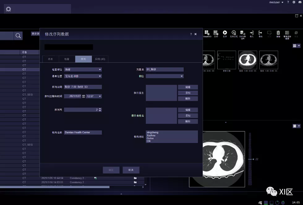 扫完CT发现体位摆错了怎么办？