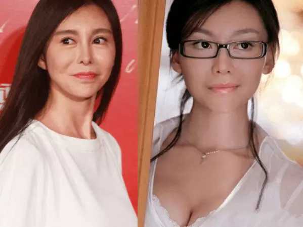 整容失败的10位明星，谁堪称“阴影”之最？