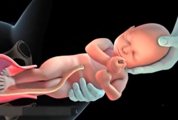 8张分娩的图片，让你了解整个顺产的过程