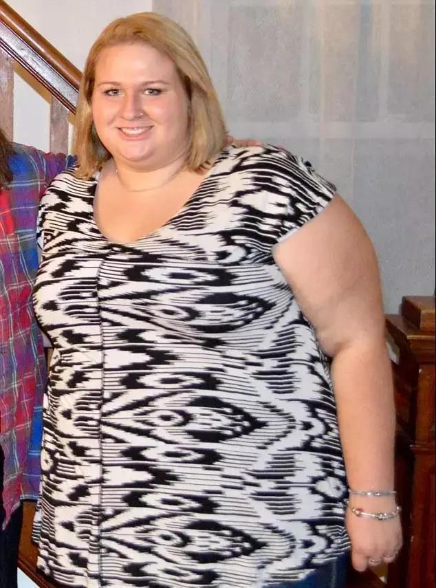 體重320斤的胖妞減肥成功後，卻被減肥後的贅皮搞得痛不欲生…