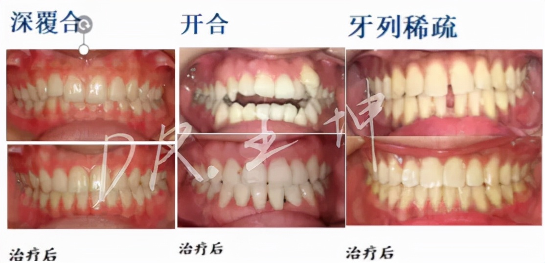 国庆福利大放送｜矫牙特惠，还有“黑科技”免费体验