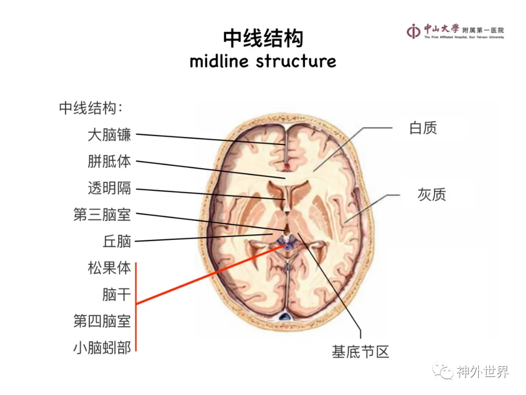 最全影像总结 | 颅内病变 MR、CT 的阅片技巧，太赞了