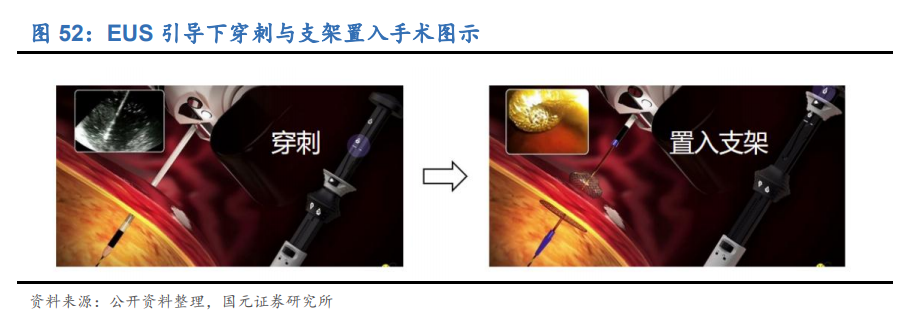 内窥镜行业深度报告：优选国产替代快车道，把握细分领域龙头