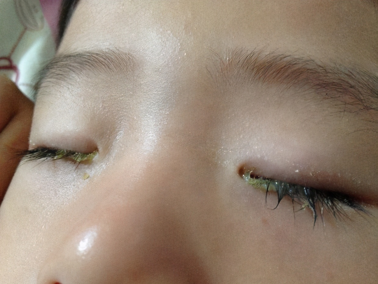 身體有這6點變化，要引起警惕，可能是肝臟亮起了警報