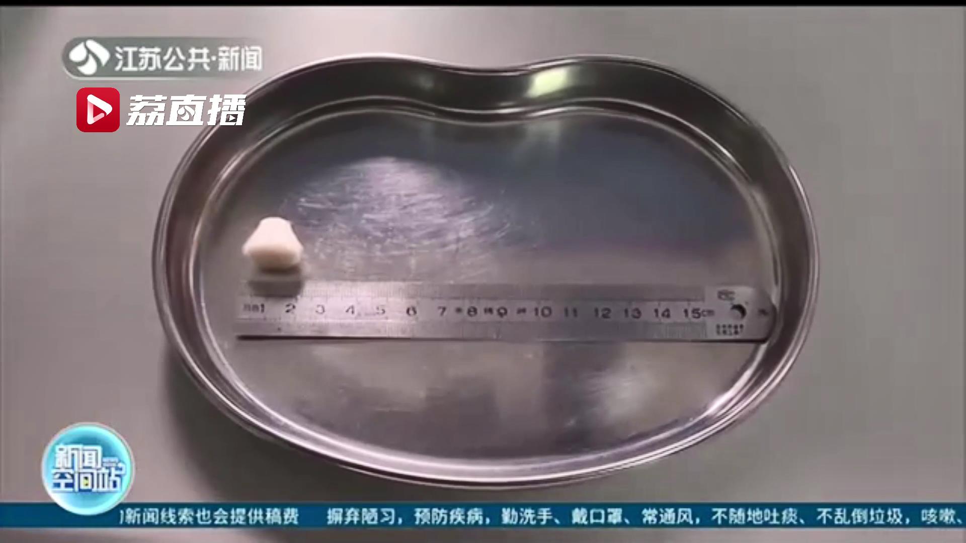 两岁男童使用电动牙刷误吞刷头 医生提醒：五岁前慎用