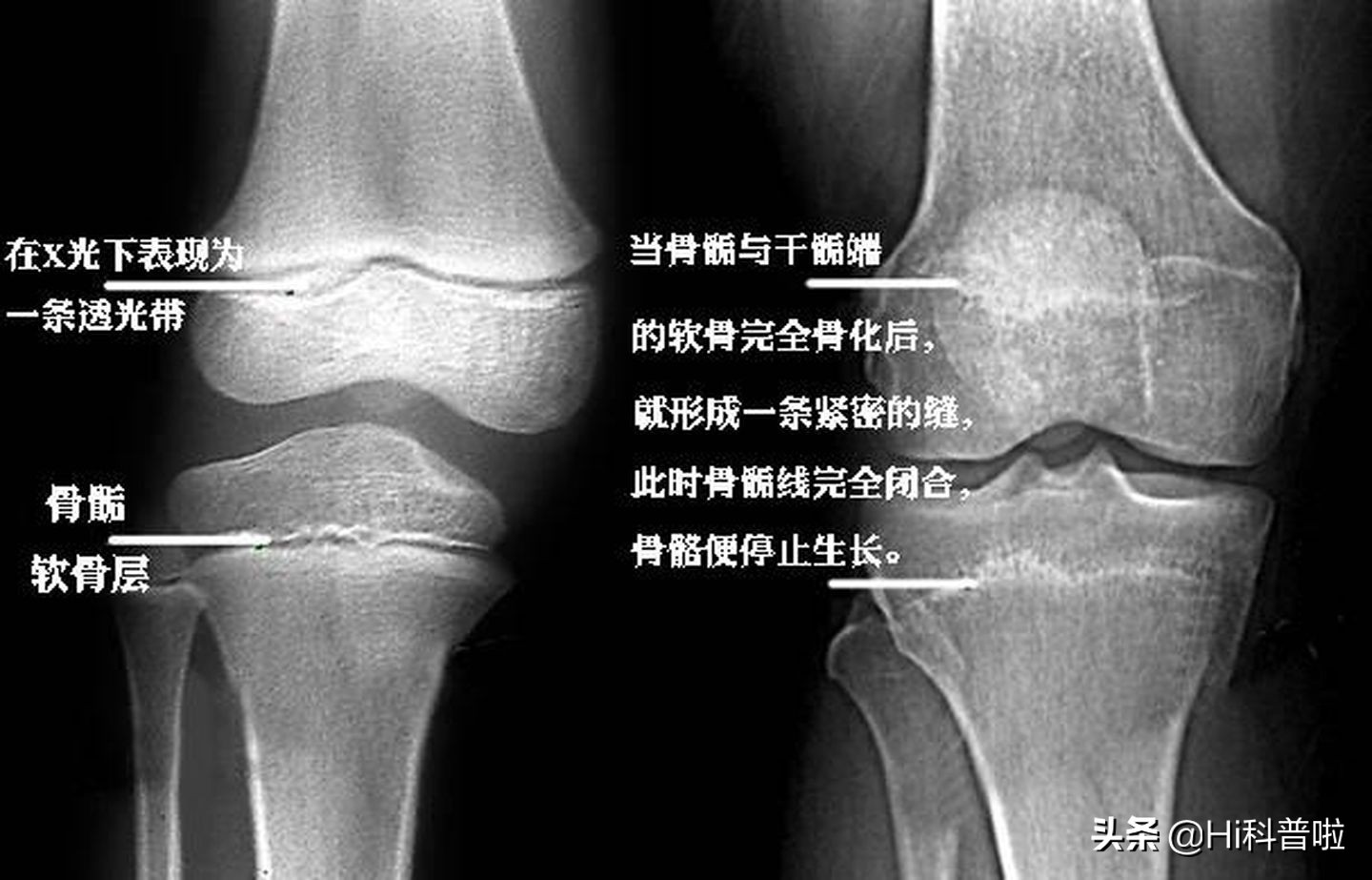 百万中国家长之殇，性早熟，毁掉孩子的“凶手”到底是谁？