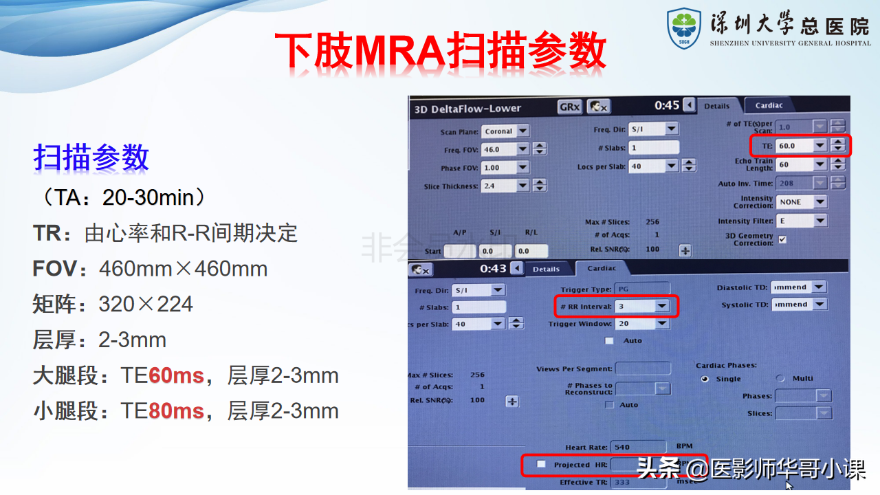 磁共振非增强双下肢血管MRA