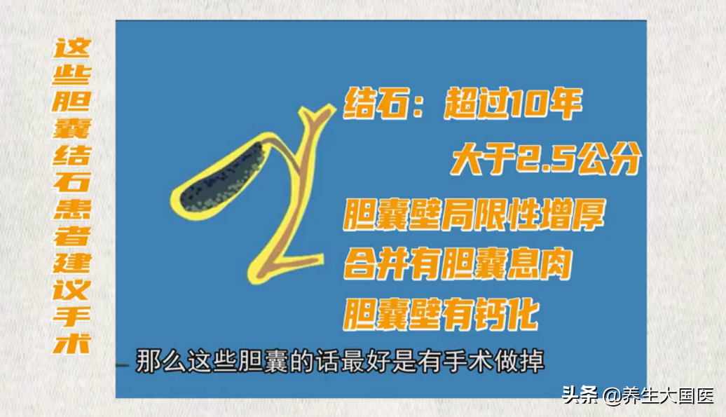 膽結石是�吃出來�的病，起病急、症狀險，身邊很常見！ 尤其偏愛這些人群