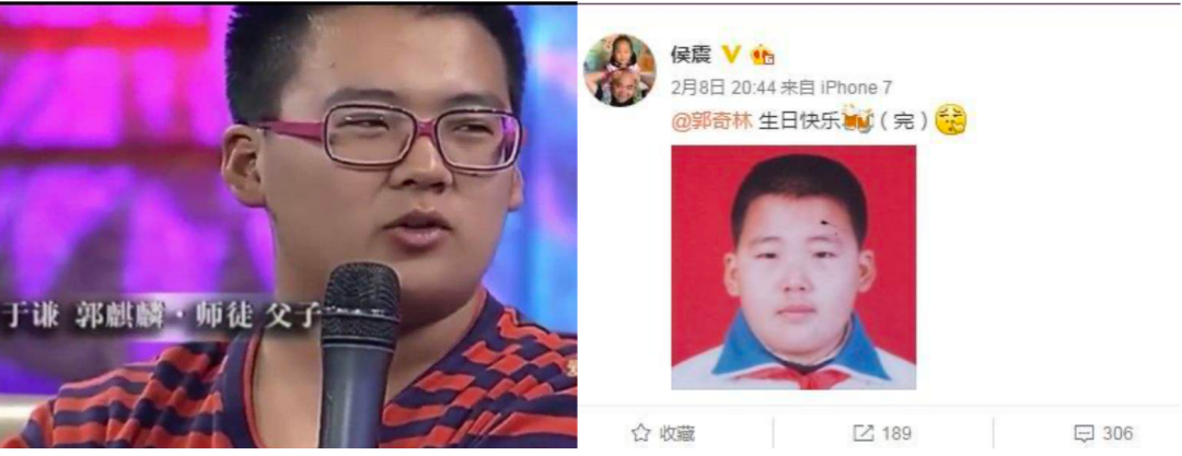 郭德纲25岁儿子患了痛风，为啥现在很多人年纪轻