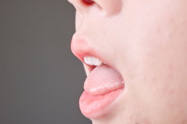 舌头下有青筋，是怎么回事？