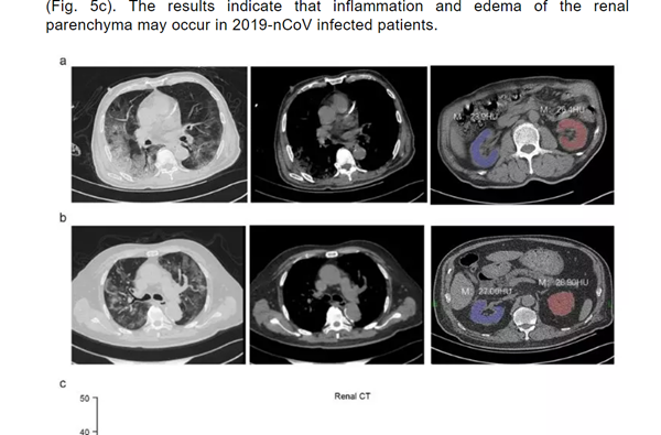 新冠后遗症大量涌现！重要器官严重损伤，揭开