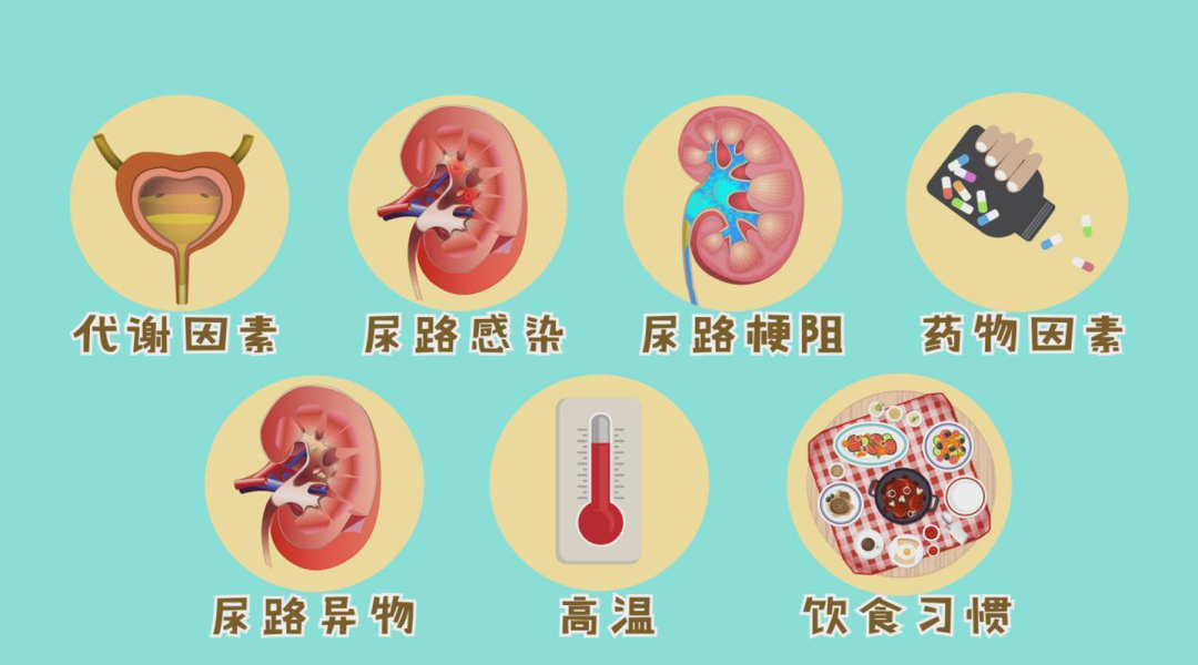 「男性健康」肾结石是泌尿外科最常见的疾病之一