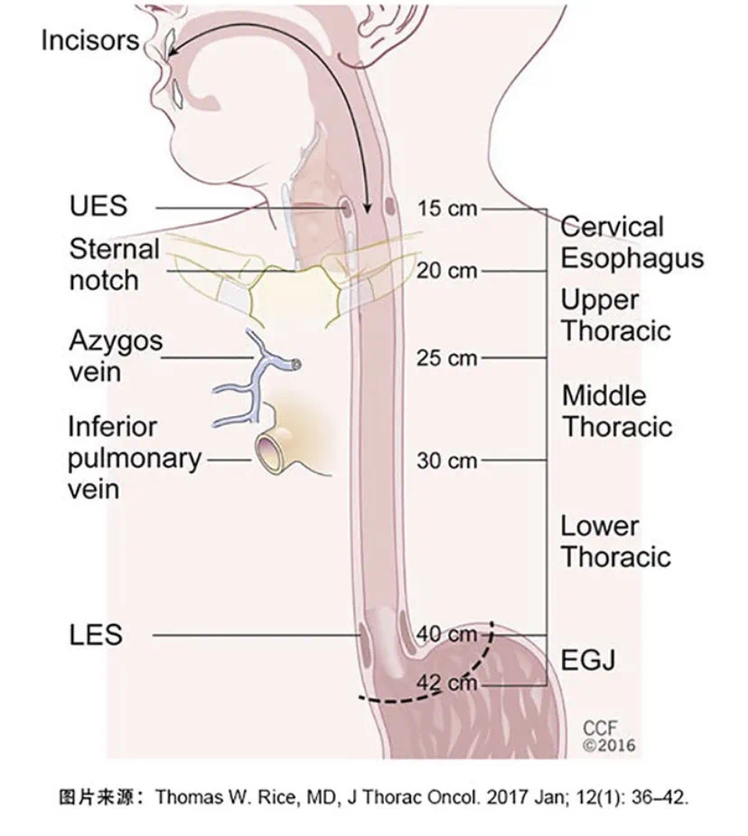 食管癌的靶向、免疫治疗有哪些？该如何选择？