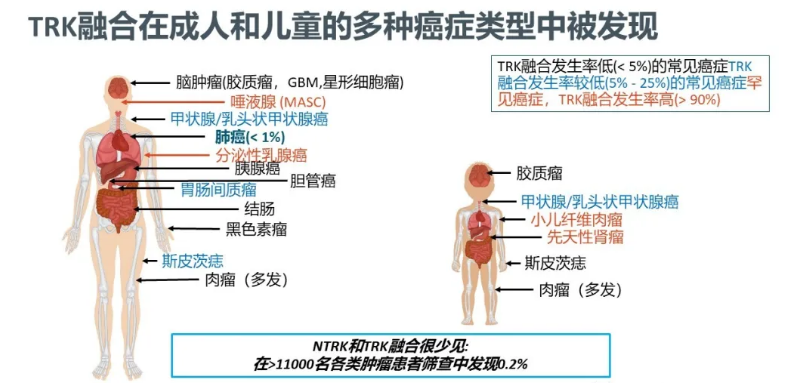 拜耳 Larotrectinib（商品名 Vitrakvi，代号 LOXO-101，拉罗替尼） 上市申请拟纳入优先审评，