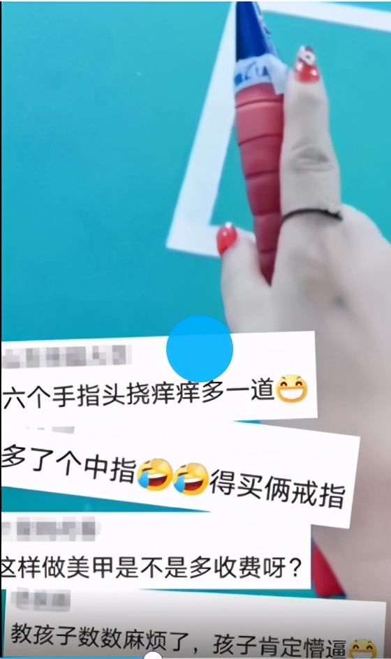 「12根」女子天生12根手指自嘲六指琴魔 心态乐观自侃做美甲费钱
