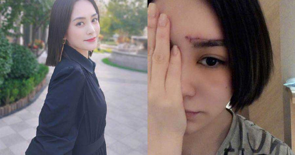 阿嬌接受專訪首談與賴弘國離婚，揚言不會再結婚，自己不適合婚姻