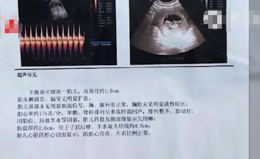 邯郸通报女精神病患者致孕案详情曝光男护工强奸女患者怀孕最新消息