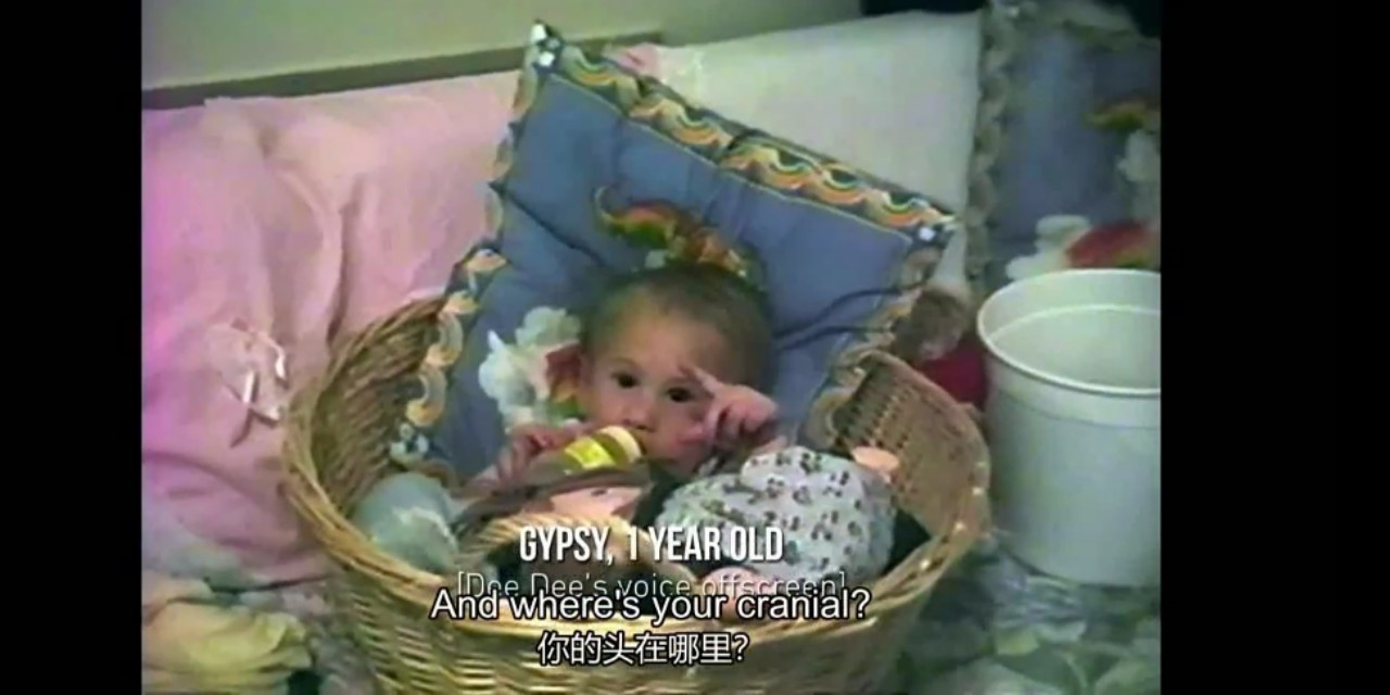 歹毒妈妈给健康女儿疯狂吃药，做上百次手术，