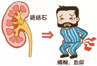 疼起来要命！小心身体中的定“石”炸弹