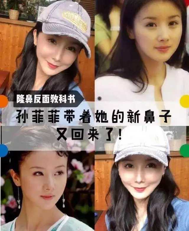 整容失败的10位明星，谁堪称“阴影”之最？