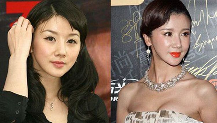 从娄艺潇到蔡明，恐怖的“硅胶脸”之下，为什