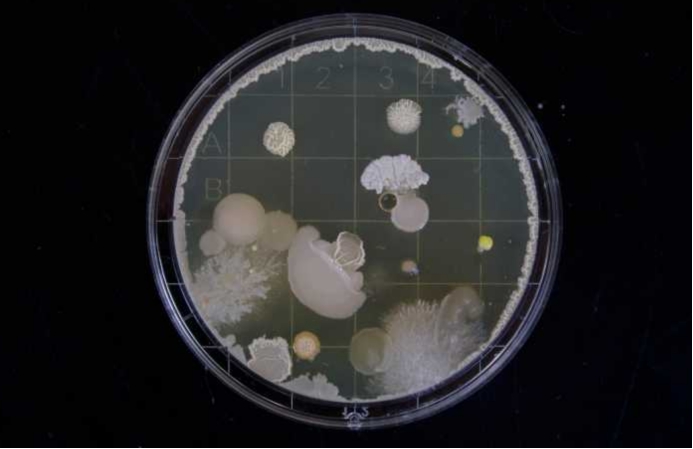 美國出現“超級真菌”疫情，已有多人被感染，感染者無法治愈