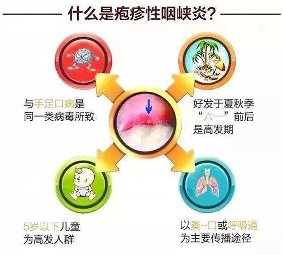 疱疹性咽峡炎，你家宝宝“中招”了吗？