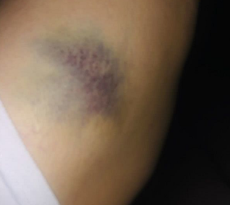 被“宝马男”殴打的女子发声：宝马是我的，之